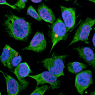 NS Reagents TDP43 Antibody (Cat-AA17-100105) Image 3